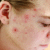 10 Skincare Myths That Are Damaging Your Skin And What to Do Instead